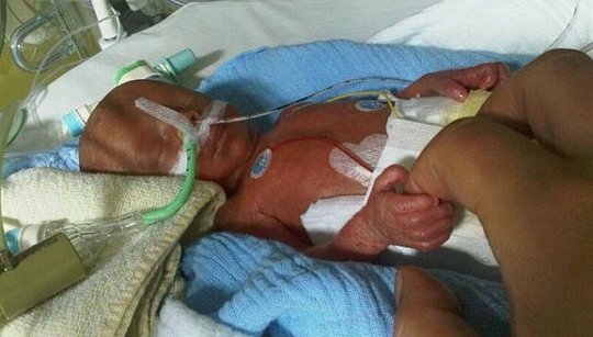 Im April 2012 mit nur 780 Gramm geboren: Der kleine Charlie musste wochenlang im Krankenhaus betreut werden. Foto. privat
