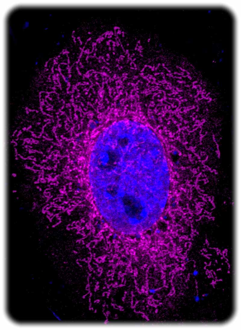 Das ARHGAP11B-Protein (Magenta) steuert in den Mitochondrien einen krebsartigen Energieprozess. Der Zellkern wird ist hier blau visualisiert. Abb.: Namba/ MPI-CBG