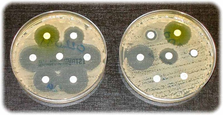 Resistenztest in der Petrischale: Die Keimkultur rechts ist bereits immun gegen fast alle Antibiotika. Foto: Dr Graham Beards, Wikipedia. CC4/GNU-Lizenz