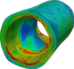 Das Computermodell visualisiert Schäden an Arterien-Wänden. Abb.: Thomas Schmidt/TUD 