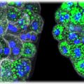 Bild von Organoiden aus Leberzellen von normalen (links) und mutierten (rechts) Mäusen, bei denen sich Lipide, also Fette, (in grün) sammeln. Wenn die beiden Gene RNF43 und ZNRF3 mutiert sind, produzieren die Leberzellen eigenständig höhere Lipidmengen, die sich auch als große Tröpfchen im Inneren jeder Zelle ansammeln (erkennbar an den Kernen in Blau und der umgebenden Zellmembran in Weiß). Mikroskopaufnahmen: Belenguer et al. Nature Communications 2022 / MPI-CBG