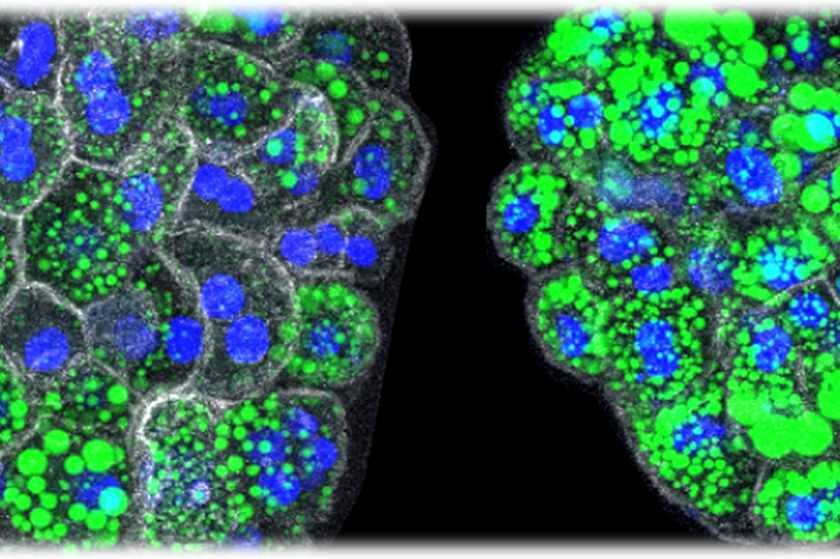 Bild von Organoiden aus Leberzellen von normalen (links) und mutierten (rechts) Mäusen, bei denen sich Lipide, also Fette, (in grün) sammeln. Wenn die beiden Gene RNF43 und ZNRF3 mutiert sind, produzieren die Leberzellen eigenständig höhere Lipidmengen, die sich auch als große Tröpfchen im Inneren jeder Zelle ansammeln (erkennbar an den Kernen in Blau und der umgebenden Zellmembran in Weiß). Mikroskopaufnahmen: Belenguer et al. Nature Communications 2022 / MPI-CBG
