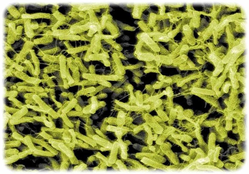 Stäbchenbakterium Clostridium difficile – ein typischer Krankenhaus-Keim, Foto: Janice Carr, CDC/ Lois S. Wiggs, Wikipedia, Public Domain