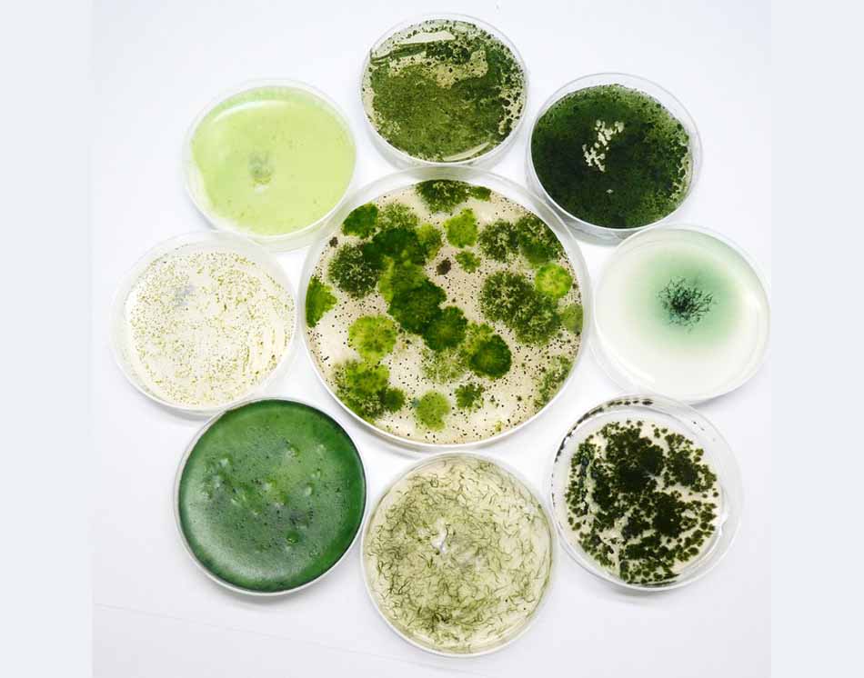 Das Team unter der Leitung von Dr. Paul D'Agostino wird 40 symbiotische und seltene Cyanobakterien sequenzieren, um daraus neue Wirkstoffe sowie Anwendungen in der Biotechnologie abzuleiten. Mikroskopfoto: Paul D'Agostino für die TUD