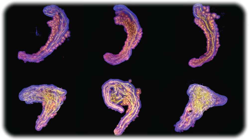 Collage von Stammzell-basierten Embryo-Modellen des embryonalen Rumpfes. Die in der oberen Reihe haben einen Hang zu Süßem, sind also stärker auf Glykolyse angewiesen, um ihre Energie zu gewinnen, was zu einem eher embryonalen Erscheinungsbild führt. Im Gegensatz dazu haben die in der unteren Reihe einen geringeren Hang zu Süßem, was dazu führt, dass sie zu viel Nervengewebe produzieren und weniger wie ein embryonaler Rumpf aussehen. Abb.: Alba Villaronga-Luque, Ryan G Savill et. al / MPI-CBG