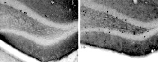 In einer Umgebung mit vielen Reizen machen Mäuse unterschiedliche Erfahrungen. Bei der einen Maus (RECHTES Foto) führt diese zu vielen neuen Nervenzellen (schwarze Punkte), bei einer anderen Maus (linkes Foto) hingegen zu deutlich weniger neuen Nervenzellen. Foto: CRTD/DZNE/Freund