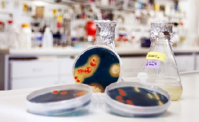 Manche Bakterien sind ganz scharf auf bestimmte Metalle - dies wollen die Freiberger für die GEwinnung strategischer Rohstoffe nutzen. Foto: TU Freiberg