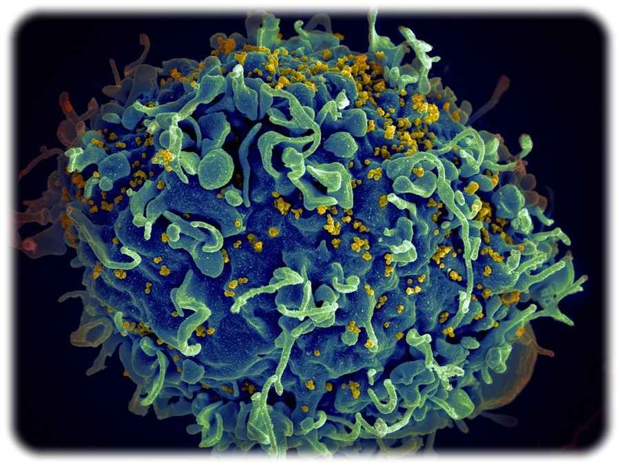 Mit dem HI-Virus (gelb) infizierte menschlische Zelle. Abb.: National Cancer Institute  