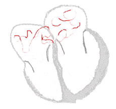 Vorhoff-Flimmern im Herzen. Animation: J. Heuser, Wikipedia, GNU-Lizenz