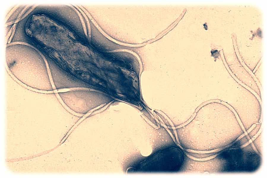 Das Magen-Bakterium Helicobacter pylori unterm Elektronenmikroskop. Abb. (bearbeitet): Yutaka Tsutsumi, Wikipedia, freie Nutzung