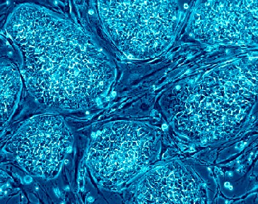 Menschliche embryonale Stammzellen. Foto: Nissim Benvenisty, Wikipedia, Lizenz CC 2.5