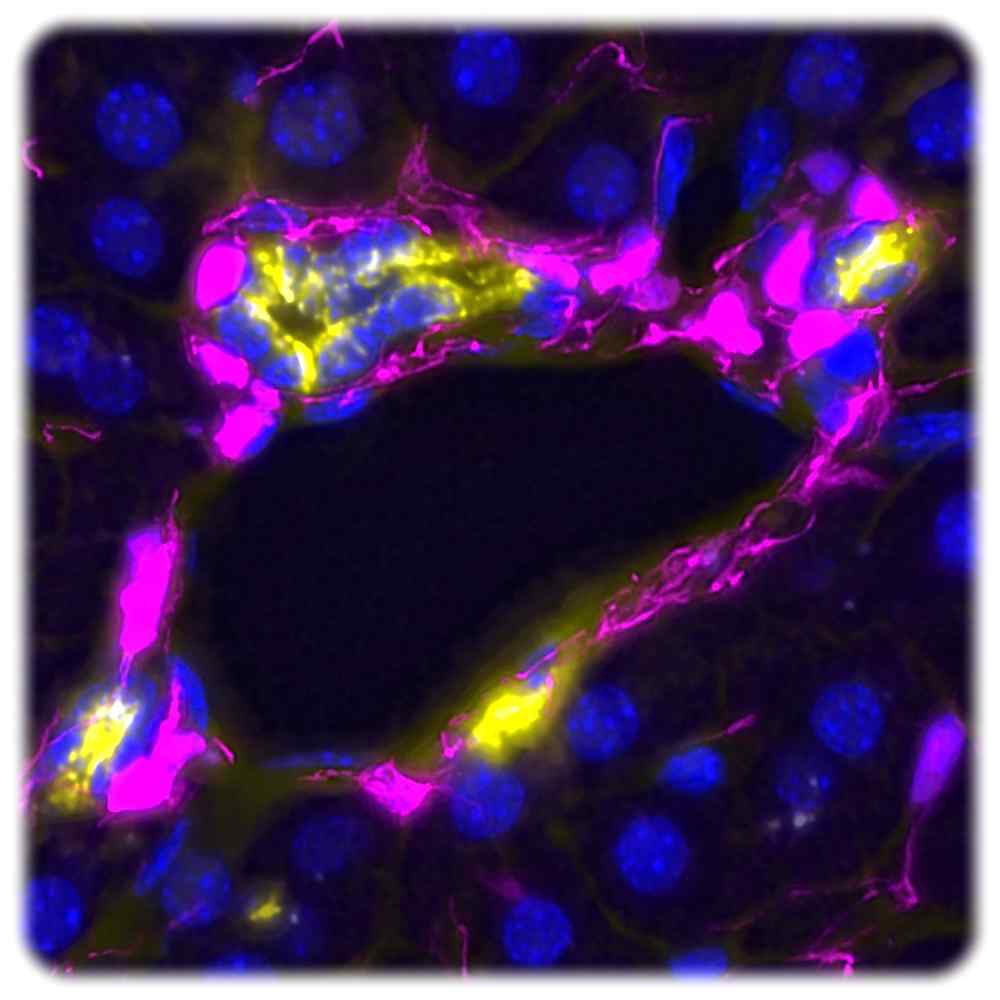 In diesem Schnitt durch Schnitt durch Lebergewebe sind die Mesenchymzellen rosa markiert. Wenn sie dei "Duktalzellen" (gelb und blau) berühren, hemmen sie deren Regeneration. Wenn sie auf Berührungen verzichten, wird die Selbstreparatur wieder angeregt. Abb.: Anna Dowbaj, Meritxell-Huch-Gruppe, MPI-CBG