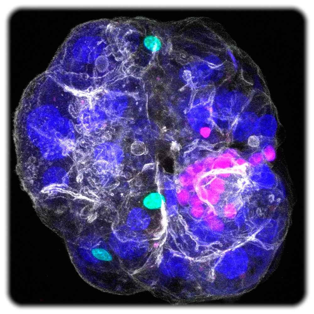 Das Leber-Organoid aus Dresde. Die drei Zelltypen sind eingefärbt: Cholangiozyten in Rosa, Portalfibroblasten in Grün und Hepatozytenkerne in Blau; alle Zellgrenzen sind in Weiß dargestellt. Abbildung: Anna M. Dowbaj, Aleksandra Sljukic u.a. in: Nature (2025) / MPI-CBG