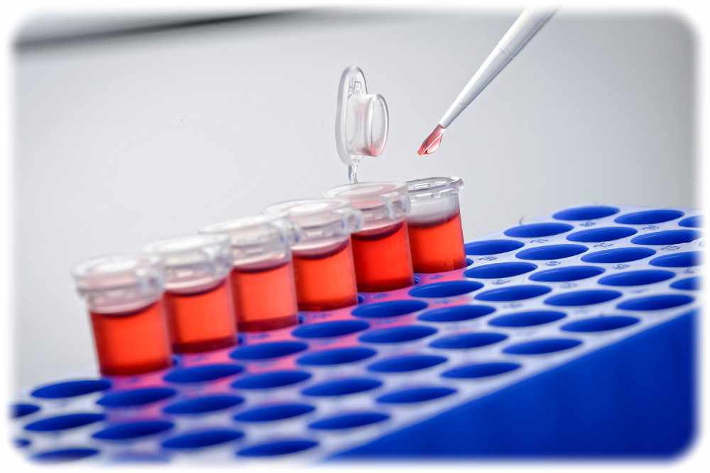 Biotype hat bereits einige Erfahrung mit der Massen-Produktion von Testkits - auch während der Corona-Zeit. Foto: Biotype GmbH