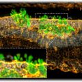 Die CRTD-Forscher haben Mäusen menschliche Zapfenphotorezeptoren (grün)in die degenerierte Netzhaut eingepflanzt. Unterstützende Zellen in der Wirtsnetzhaut (orange) interagieren eng mit dem Transplantat. Abb.: JCI