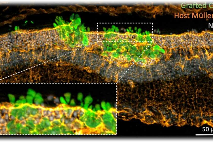 Die CRTD-Forscher haben Mäusen menschliche Zapfenphotorezeptoren (grün)in die degenerierte Netzhaut eingepflanzt. Unterstützende Zellen in der Wirtsnetzhaut (orange) interagieren eng mit dem Transplantat. Abb.: JCI