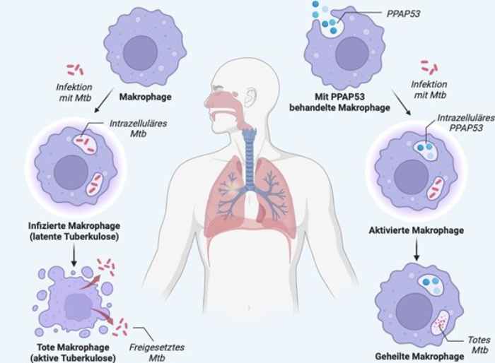 Verlauf einer Tuberkulose-Infektion mit und ohne Behandlung mit dem "PPAP53"-Wirkstoff. Grafik: TUD