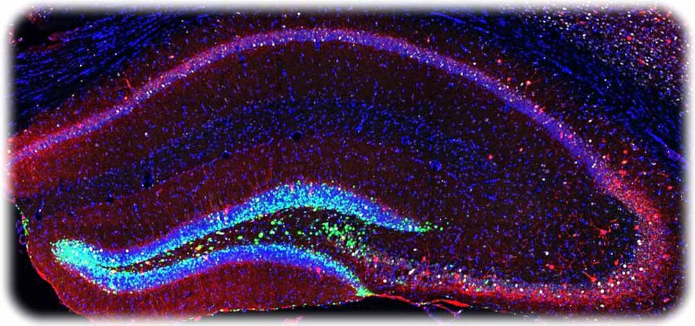 Neurale Stammzellen und künstlich erzeugte Neuronen (grün) vernetzten sich im Hippocampus genannten Gehirnareal einer Maus mit reifen Zellen (rot). Dadurch gewinnen die alten Mäuse Fähigkeitem zurück, flexibel wie junge Mäuse zu navigieren und sich an mehr Details zu erinnern. Abb.: CRTD der TUD