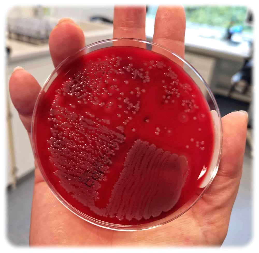 Pertischale mit angesetzten Bakterienkulturen in der Mikrobiologie im Uniklinikum Dresden. Foto: Heiko Weckbrodt