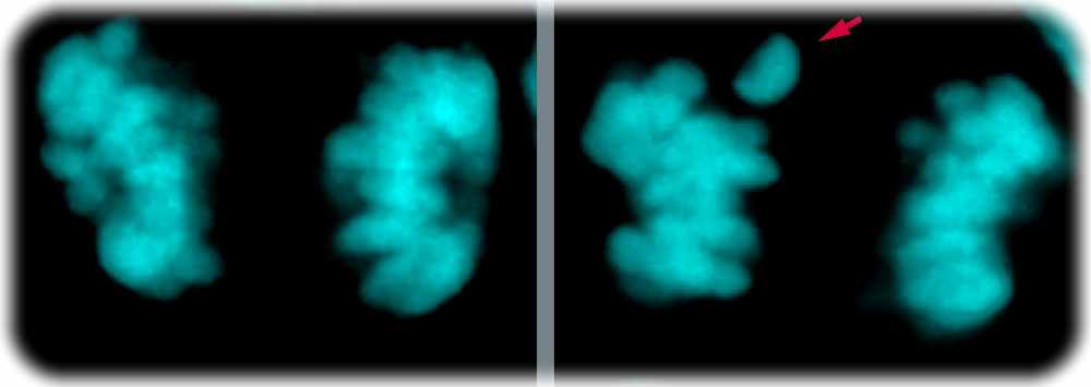 Weniger Chromosomentrennungsfehler in neuronalen Stammzellen des modernen Menschen im Vergleich zum Neandertaler. Linke Seite: Mikroskopaufnahme der Chromosomen (in Cyan) einer neuronalen Stammzelle des modernen Menschen im Neokortex während der Zellteilung. Rechte Seite: dieselbe Aufnahme, aber von einer Zelle, in der drei Aminosäuren in den beiden Proteinen KIF18a und KNL1, die an der Chromosomentrennung beteiligt sind, von der modernen menschlichen Variante zur Neandertaler-Variante verändert wurden. Diese "neandertalisierten" Zellen weisen doppelt so viele Chromosomenverteilungsfehler auf (roter Pfeil). Aufnahme: Felipe Mora-Bermúdez / MPI-CBG 