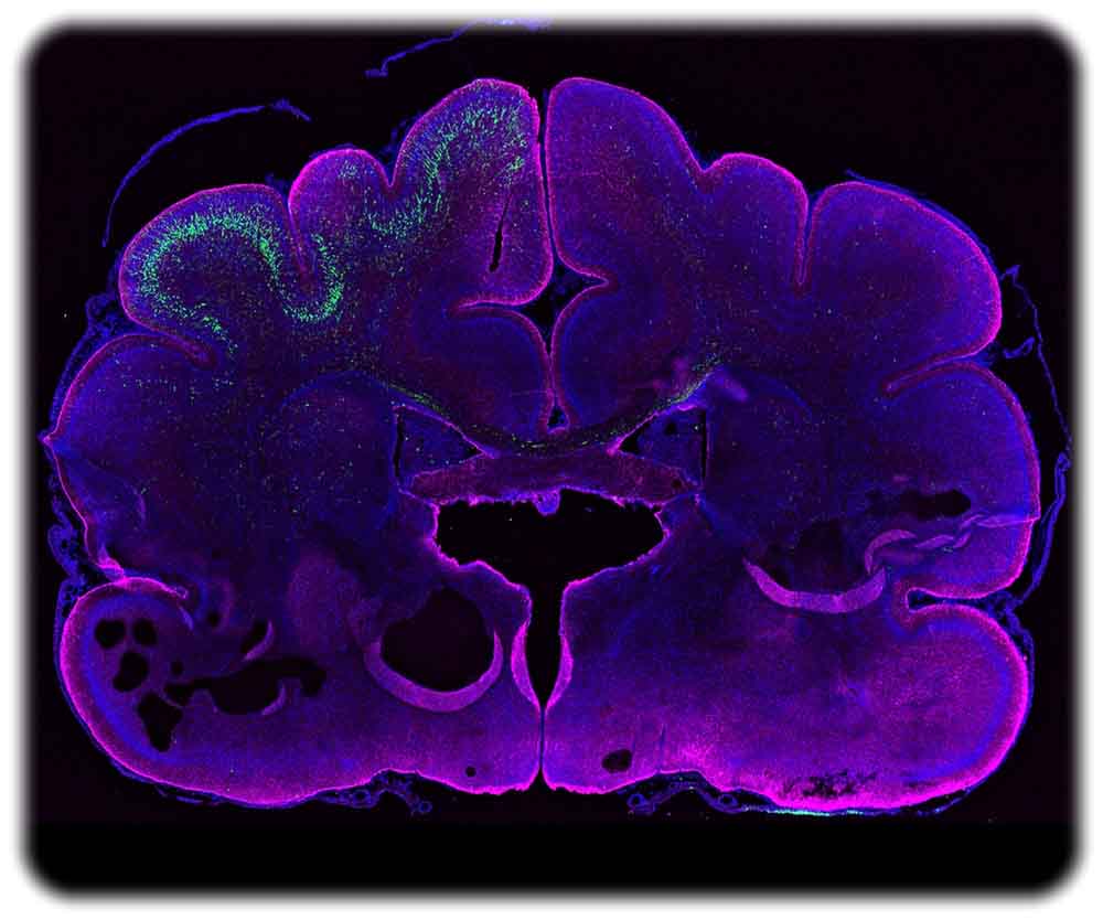 Das Bild zeigt ein Frettchen-Gehirn. Die Farbe Magenta markiert Gliazellen und zeigt die äußere Kontur des Gehirns. Der grüne Bereich enthält Neurone, mit ARHGAP11B-Genen. Foto (bearbeitet): Kalebic / Gilardi / MPI-CBG