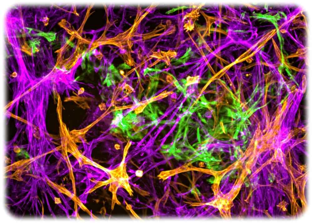 Die Mikroskop-Aufnahme zeigt Netzwerke aus Nervenzellen in einer Zellkultur. Mikroskopbild: Kizil Lab, DZNE