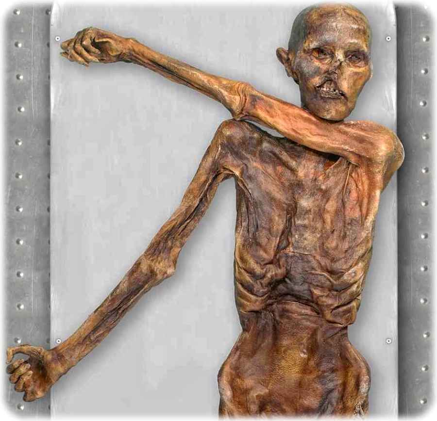 Ötzi hatte schon zu Lebzeiten Glatze. Foto: Südtiroler Archäologiemuseum/ EURAC/ Marco Samadelli-Gregor Staschitz