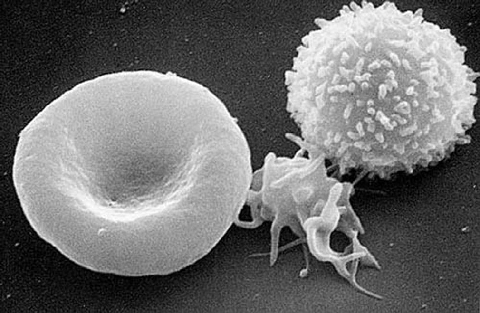 Wenn der Anteil weißer Zellen (Leukozyten, rechts) im Blut drastisch ansteigt, kann eine Hyperleukozytose, eine besondere Form der akuten Leukämie, vorliegen. Dann ist ein rascher Therapie-Beginn entscheidend. Elektronenmikroskop-Aufnahme: NCI-Frederick, Wikipedia, Public Domain