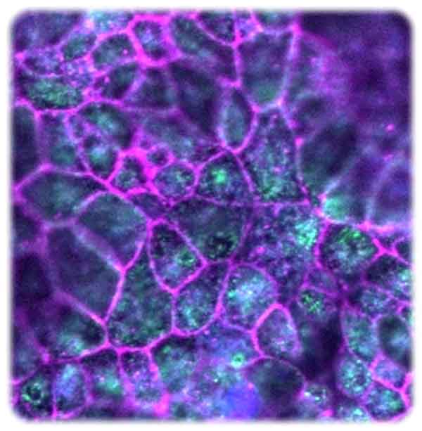 Netzhaut-Zellen unter dem Mikroskop. Foto: Dr. Richard Wetzel