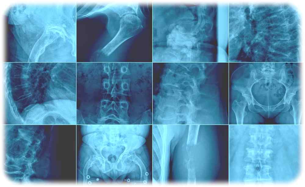 Auf solchen Röntgenaufnahmen suchen die Medizinern nach Anzeichen von Knochentumoren. Quelle: Hochschulmedizin Dresden