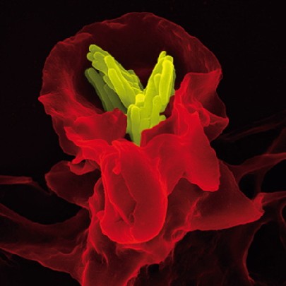Sieht wie eine exotische Blüte aus, ist aber ein Blutkörperchen (rot) unter dem Mikroskop, das gerade Tuberkulosebakterien (gelb) frisst. Abb.: Max-Planck-Institut für Infektionsbiologie / Volker Brinkmann 