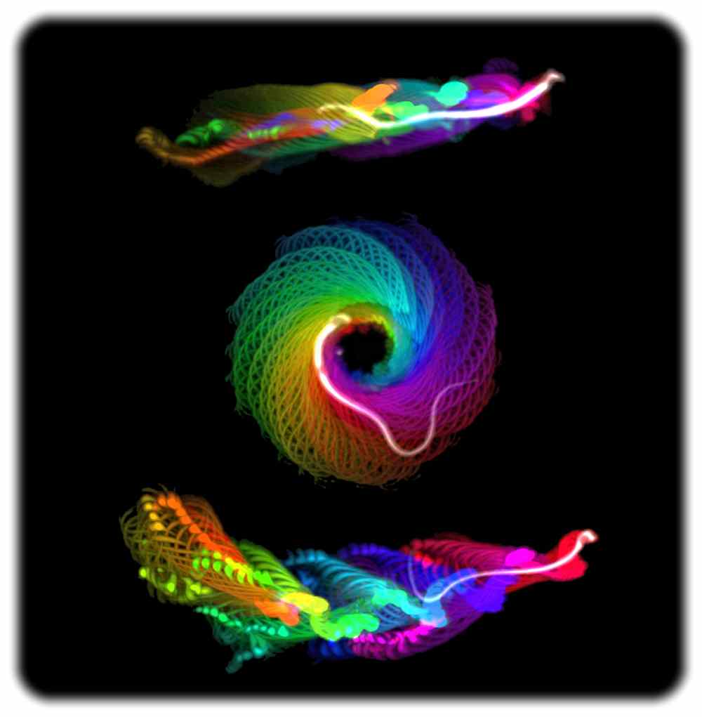 Die computergestützte Analyse von lichtmikroskopischen Daten zeigen einerseits den linearen Schwimmweg eines normalen Spermiums (oben) und die abnormen kreisförmigen und diagonalen Schwimmwege der mutierten Spermien (Mitte und unten), bei denen während der Glycylierung etwas schief gelaufen ist. Abb.: Gadadhar u.a. / Science 2021