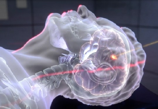 Die Visualisierung zeigt den Einsatz hochbeschleunigter Atomkerne beim Kampf gegen Hirntumore. AI Films