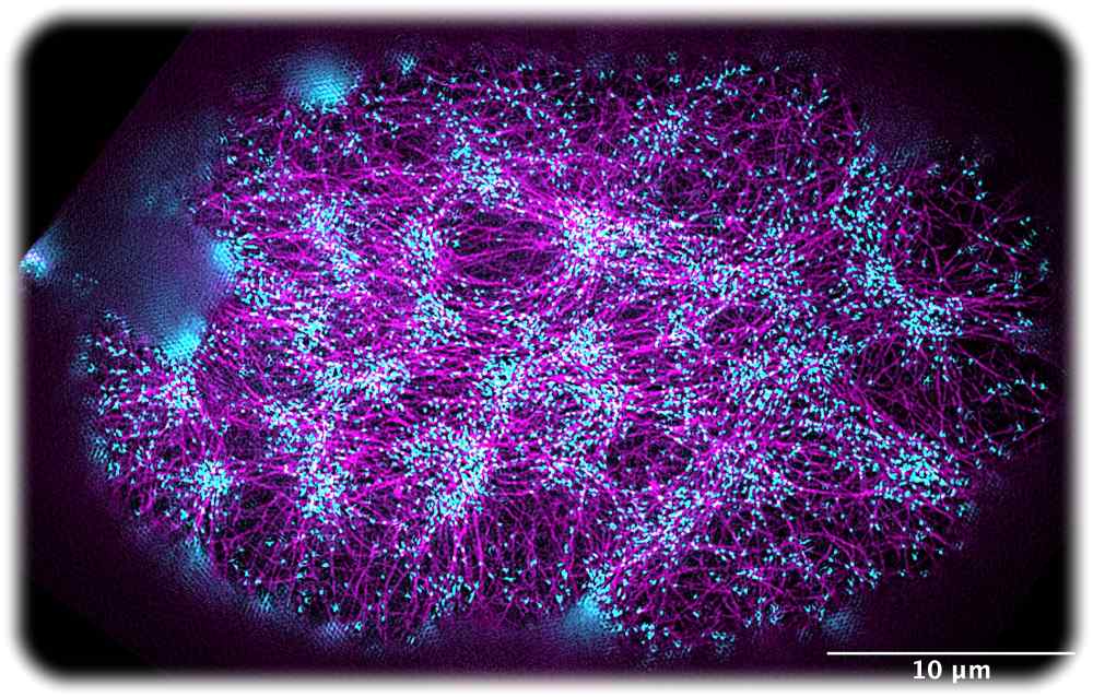 Bild des Aktomyosin-Kortex in einem einzelligen Embryo, aufgenommen mit hochauflösender Fluoreszenzmikroskopie. Die Aktinfilamente sind magentafarben markiert, die Bereiche, in denen Kräfte und Drehmomente erzeugt werden, sind cyanfarben markiert. Mikroskopaufnahme: Sylvia Hurlimann / Middelkoop et al. PNAS, 18. Mai 2021 / MPI-CBG