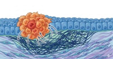 Frühe Tumorzellen verändern das umliegende Stützgewebe so, dass eine Umgebung entsteht, die ihr Überleben und weiteres Wachstum erleichtert. In diesen Prozess sind Bindegewebe, Fibroblasten und Immunzellen aktiv eingebunden. Abb.: adaptiert aus: Skrupskelyte, G. et al., Nature (2026)