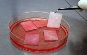 Aus Mundschleinhaut-Stücken, die etwa so groß sind, wie ein Viertel einer Cent-Münze wachsen in drei Wochen auf einem speziellen Trägermaterial pateinteneigene Zellimplantate heran. Abb. (3): UroTiss