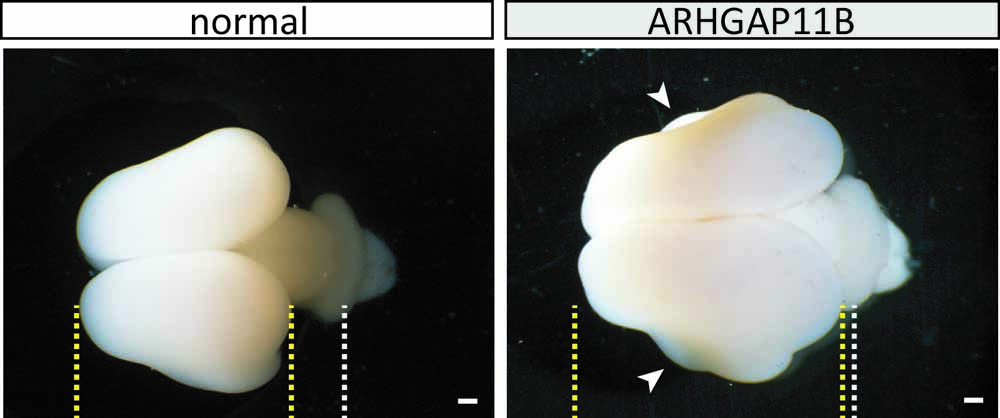Die Abbildungen zeigen normale (links) und durch das Gen ARHGAP11B vergrößerte Weißbüschelaffenhirne. Abb.: Heide et al. / MPI-CBG