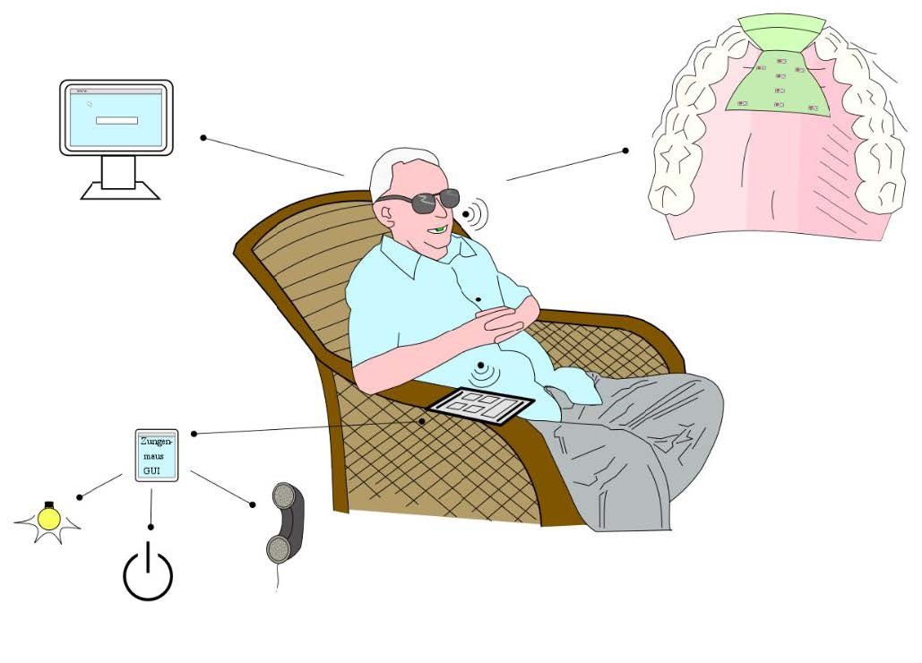 Mit der Zungenmaus im Mund sollen Senioren, die sich nicht mehr auf ihre Hände verlassen können, zum Beispiel ihren Rollstuhl, den Fernseher oder ihren PC steuern. Grafik: Christoph Wagner, für TUD und Linguwerk