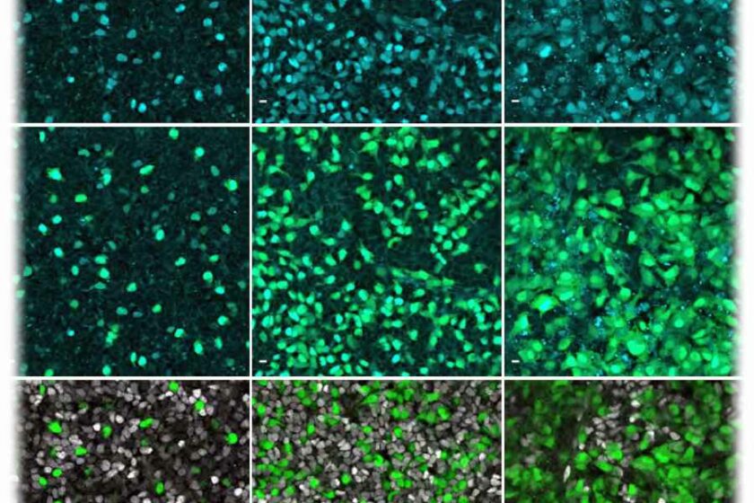Die Aufnahmen zeigen das Gen "Neurog3" (hellblau) in menschlichen Zellen der Bauchspeicheldrüse. Abbildung: Beydag-Tasöz u.a., Developmental Cell, via MPI-CBG