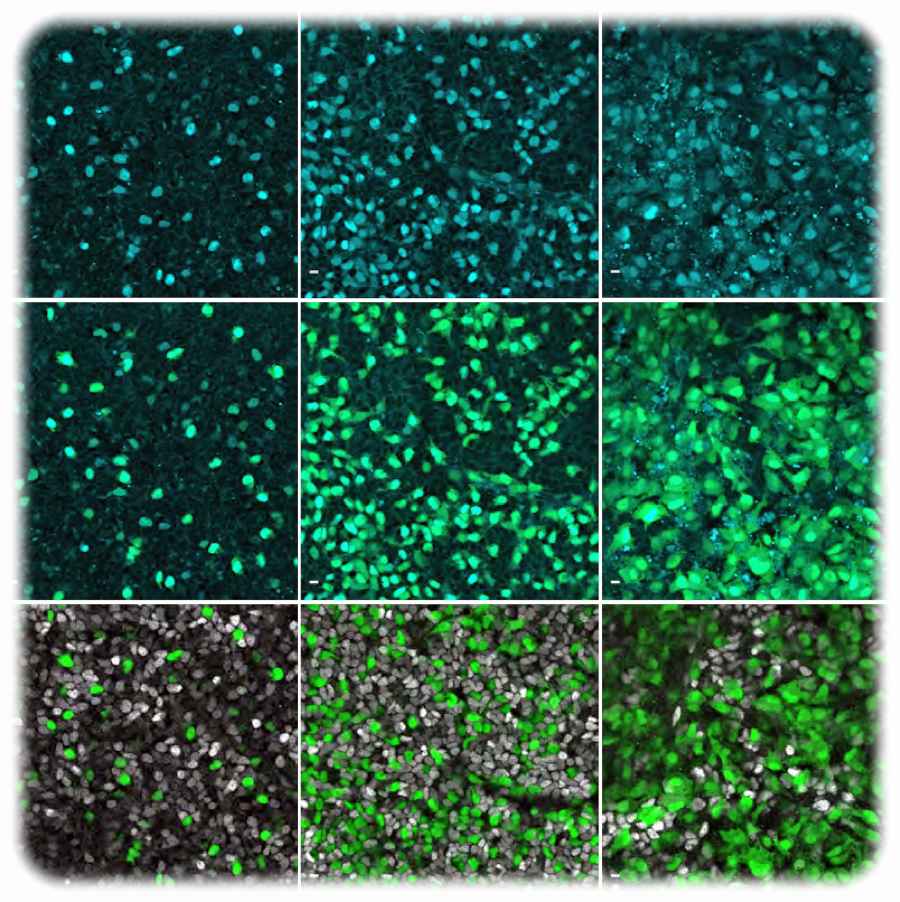 Die Aufnahmen zeigen das Gen "Neurog3" (hellblau) in menschlichen Zellen der Bauchspeicheldrüse. Abbildung: Beydag-Tasöz u.a., Developmental Cell, via MPI-CBG 