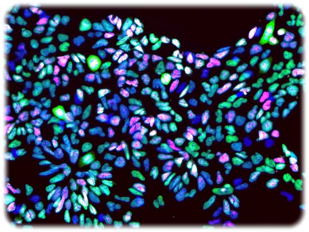 Für zellbasierte Therapien benötigen die Entwickler zunächst Zellkulturen - wie diese Nervenzellen, die aus Stammzellen gewonnen wurden. Foto: Dr. Richard Wetzel