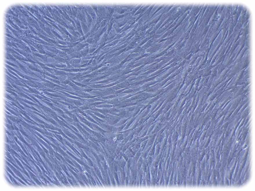 So sehen mesenchymale Stromazellen unterm Mikrokop aus. Sie werden aus dem gallertartigen, gefäßfreien Inneren der Nabelschnur von gesunden Neugeborenen gewonnen. Foto: Hochschulmedizin Dresden