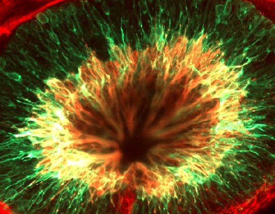 Blick von oben auf ein Zebrafischauge. Die roten und grünen Zellen sind Neuronen und der „Tunnel“ in der Mitte ist der Sehnerv. Foto: MPI-CBG